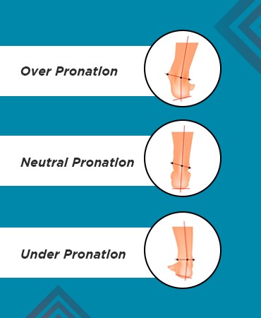 How to choose running shoes-Pronation Control